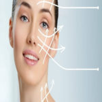 esc4-Hilos-tensores-PDO-(Polidioxanona)